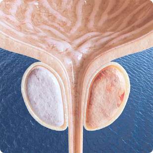 Calm Inflammation & Shrink Swelling